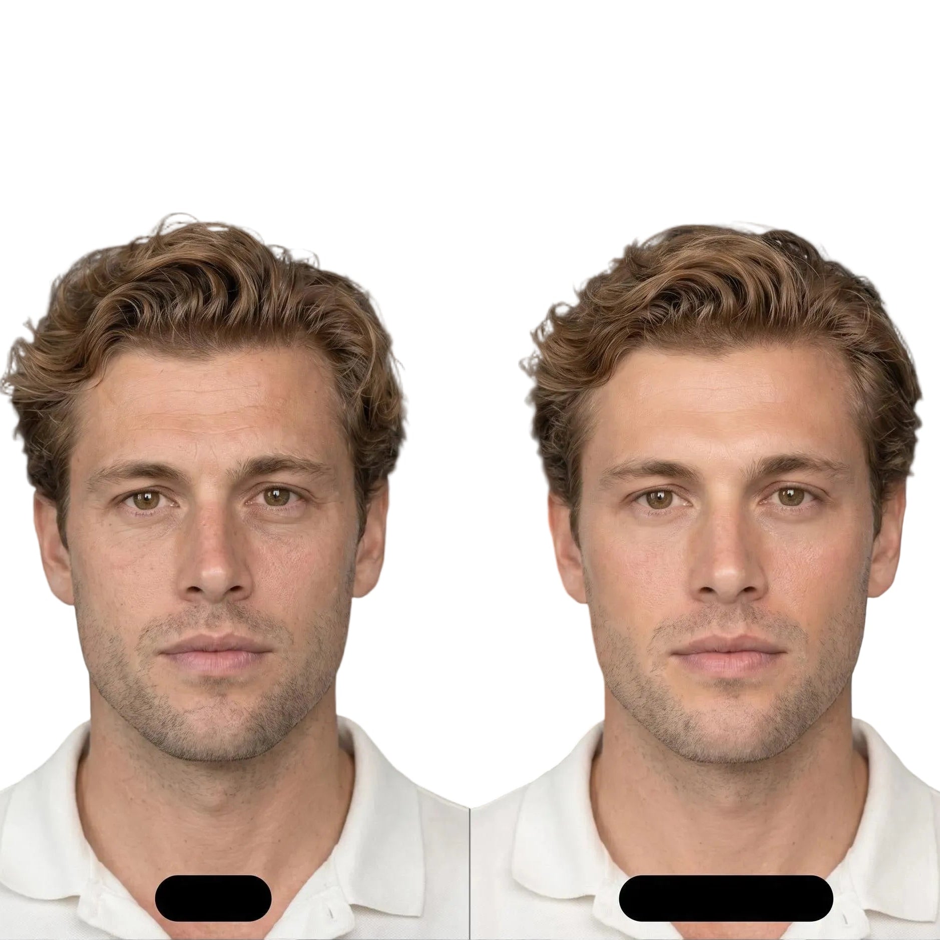 Natural Retinol Oil Serum - Before After Transformation | OLIRS Men's Skincare